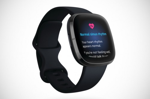 Fitbit Sense: Mit EKG- und Stresslevel-Messung als Apple-Watch-Konkurrent?